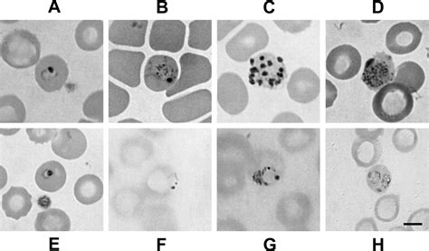  Hepatocystis! Uma Jornada Fascinante no Interior da Floresta Tropical com este Parasita Inesperado