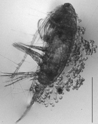  Zoothamnium: Um Predador Microscopicamente Incrivelmente Apetitoso e com um Estilo de Vida Extraordinariamente Móvel!