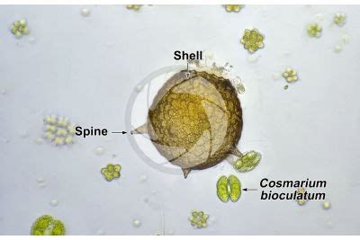  Aculeata: Uma explosão de vida microscópica com tentáculos em constante movimento!