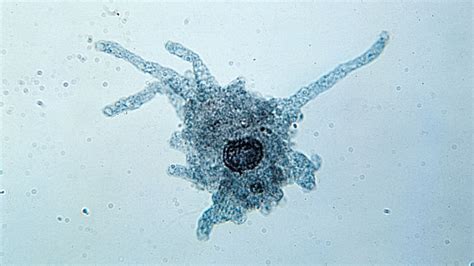  Breviata! Uma Jornada Microscopicamente Fascinante Através da Natureza Inconstante dos Amoebozoários