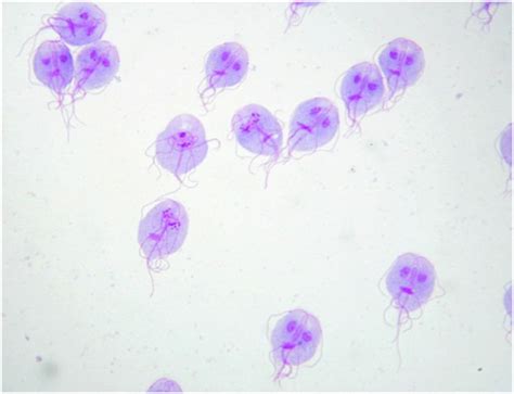  Giardia: Uma Criatura Microscópica que Faz um Banquete com seu Intestino!