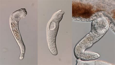  Zygophyllum! Descubra Este Parasita Unicelular Que Infecta Plantas, Animais e Mesmo Humanos